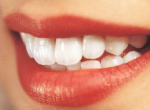 Abbagliante sorriso