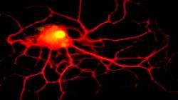 Erotico neurone