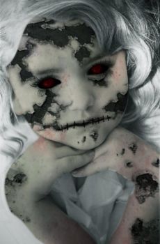 Dementia