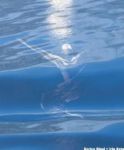 Apnea